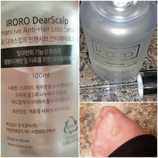 RORO 디어스 캘프 인핸 시브 안티 헤어 로스 세럼 — 5점을 준 리뷰어가 2019년 12월 올린 사용 사진