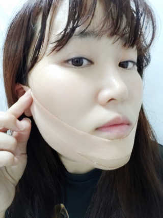 아이디플라코스메틱 아이디 페이스핏 마이너스 밴드 — 4점을 준 리뷰어가 2019년 9월 올린 사용 사진