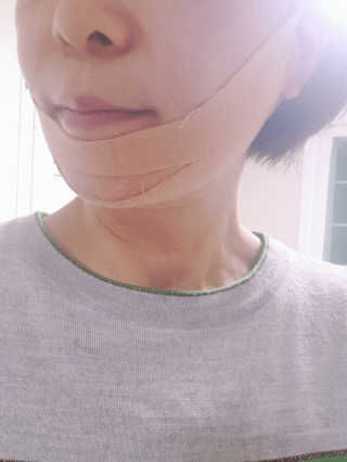 아이디플라코스메틱 아이디 페이스핏 마이너스 밴드 — 5점을 준 리뷰어가 2019년 12월 올린 사용 사진