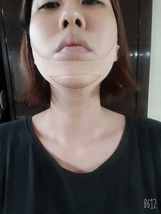 아이디플라코스메틱 아이디 페이스핏 마이너스 밴드 — 4점을 준 리뷰어가 2019년 11월 올린 사용 사진