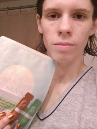 아이뽀 모든 피부 타입을위한 AIPPO Expert Hydrating Mask — 5점을 준 리뷰어가 2018년 2월 올린 사용 사진
