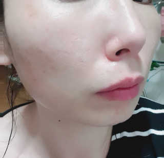 이니스프리 수퍼 화산송이 클레이 무스 마스크 2X — 5점을 준 리뷰어가 2019년 6월 올린 사용 사진