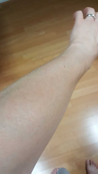 일리윤 세라마이드 아토 집중 크림 — 5점을 준 리뷰어가 2017년 10월 올린 사용 사진