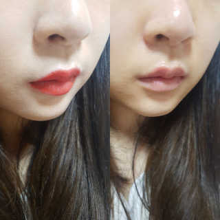 나이팅게일 데일리 더마 클렌징패드 마일드 — 5점을 준 리뷰어가 2017년 10월 올린 사용 사진