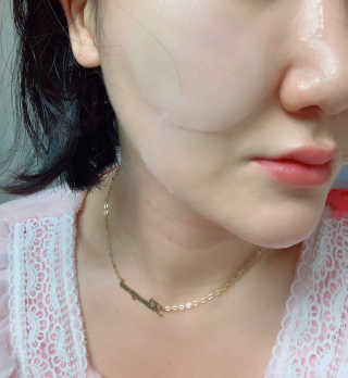 자이엘 S.O.S 레드 칙 케어팩 2 Box — 5점을 준 리뷰어가 2020년 2월 올린 사용 사진