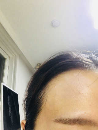 더연 리파이닝 칼라민크림 — 5점을 준 리뷰어가 2017년 11월 올린 사용 사진