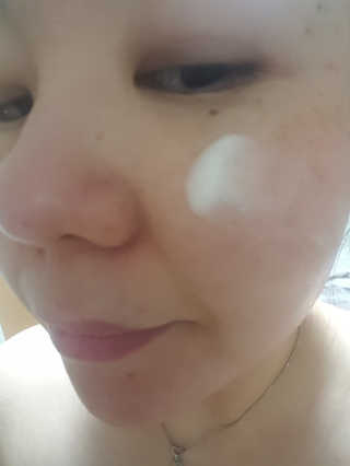 엘리자베카 펩타이드 쓰리디 픽스 슈팅 버블 페이셜 에센스 — 5점을 준 리뷰어가 2018년 7월 올린 사용 사진