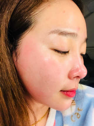 리얼베리어 액티브 브이 퍼스트 오일 — 4점을 준 리뷰어가 2019년 1월 올린 사용 사진