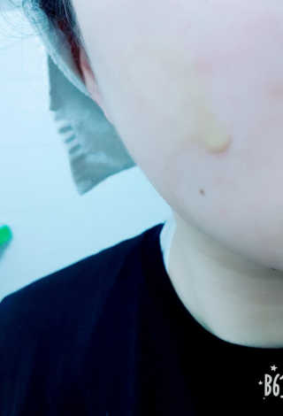 보타니티 [홍]조[진]정[결]케어 플라본 세럼 — 4.67점을 준 리뷰어가 2018년 5월 올린 사용 사진