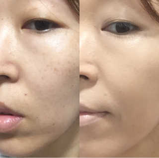 미우미우님이 올린 리뷰 사진 4
