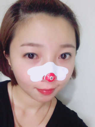 나이팅게일 TAKO PACK NOSE [문어코팩] — 5점을 준 리뷰어가 2017년 5월 올린 사용 사진