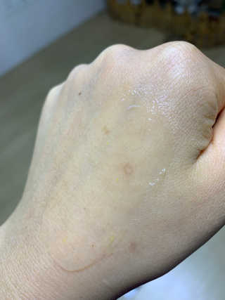 타임인네이처 [더메디닥터] 카렌듈라 엔자임 필링젤 — 3.5점을 준 리뷰어가 2019년 2월 올린 사용 사진