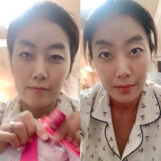 스케덤 펩타이드 리프팅밴드 — 4.5점을 준 리뷰어가 2019년 6월 올린 사용 사진