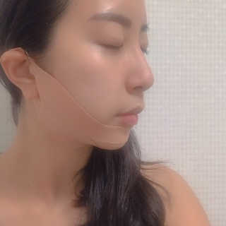 아이디플라코스메틱 아이디 페이스핏 마이너스 밴드 — 3점을 준 리뷰어가 2019년 9월 올린 사용 사진