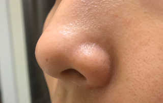 메디힐 슬리핑 멜팅 코팩 — 5점을 준 리뷰어가 2020년 1월 올린 사용 사진