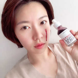 쏘내추럴 레드 필 팅글 세럼 오리지널 — 5점을 준 리뷰어가 2019년 8월 올린 사용 사진