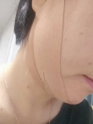 아이디플라코스메틱 아이디 페이스핏 마이너스 밴드 — 3.5점을 준 리뷰어가 2019년 12월 올린 사용 사진