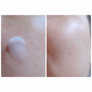 로벡틴 시카 케어 밤 — 5점을 준 리뷰어가 2019년 6월 올린 사용 사진