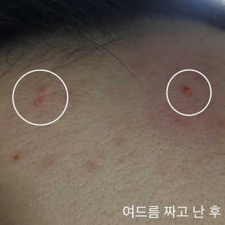 23years old 바데카실 오리지널 — 3.33점을 준 리뷰어가 2017년 12월 올린 사용 사진