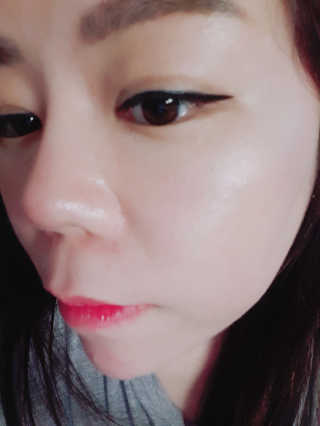 보타니티 [홍]조[진]정[결]케어 플라본 세럼 — 5점을 준 리뷰어가 2018년 5월 올린 사용 사진