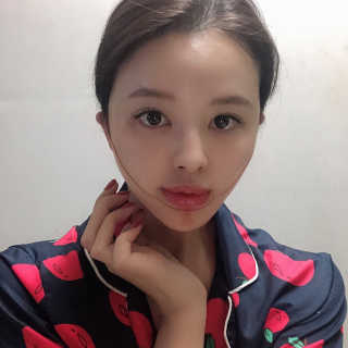 아이디플라코스메틱 아이디 페이스핏 마이너스 밴드 — 5점을 준 리뷰어가 2019년 11월 올린 사용 사진