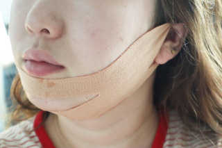 아이디플라코스메틱 아이디 페이스핏 마이너스 밴드 — 4점을 준 리뷰어가 2019년 10월 올린 사용 사진