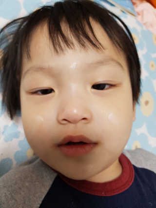 바이더닥터 아토 크림 — 4.67점을 준 리뷰어가 2018년 5월 올린 사용 사진