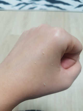 타임인네이처 [더메디닥터] 카렌듈라 엔자임 필링젤 — 5점을 준 리뷰어가 2019년 2월 올린 사용 사진