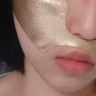 [스케덤] 상악밴드 — 4.5점을 준 리뷰어가 2019년 7월 올린 사용 사진