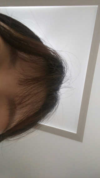 다슈코리아 다슈 데일리 탈모완화 초강력 헤어 스프레이 — 4.33점을 준 리뷰어가 2018년 1월 올린 사용 사진