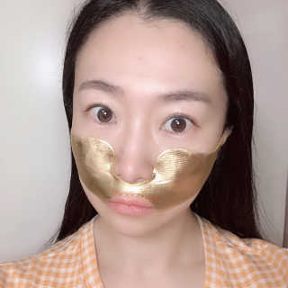 [스케덤] 상악밴드 — 4점을 준 리뷰어가 2019년 6월 올린 사용 사진