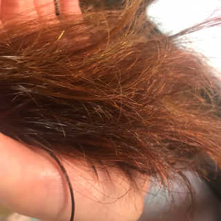 보타미안  엔젤모링가 아쿠아베리어 팩 — 4.17점을 준 리뷰어가 2018년 2월 올린 사용 사진