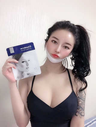 스케덤 클루덤 리프팅 패치 — 4.5점을 준 리뷰어가 2019년 4월 올린 사용 사진