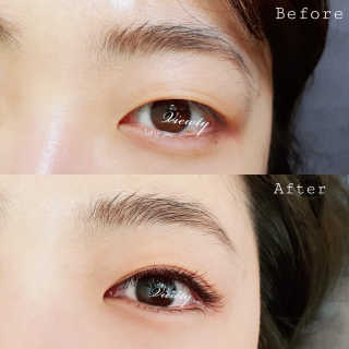Viewty Skin and Lash [ViewtySkin＆Lash] 종아리 림프순환 부종관리 — 5점을 준 리뷰어가 2019년 3월 올린 사용 사진