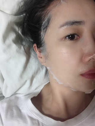 acelabs 에이스랩 시트마스크 5종 10매 — 4점을 준 리뷰어가 2019년 2월 올린 사용 사진