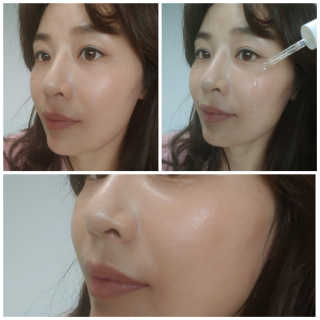 쏘내추럴 실크 콜라겐 글로우 앰플 — 4.5점을 준 리뷰어가 2019년 7월 올린 사용 사진