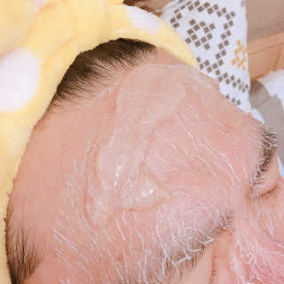 23years old 인쎄라 실프팅 쁘띠 마스크(5장) — 5점을 준 리뷰어가 2017년 5월 올린 사용 사진