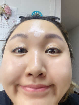 캐치미패치 트러블 스팟패치 — 4점을 준 리뷰어가 2019년 12월 올린 사용 사진