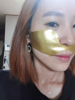 [스케덤] 상악밴드 — 5점을 준 리뷰어가 2019년 8월 올린 사용 사진