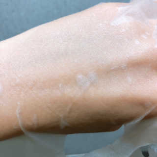 보타메디 씨놀®미라클마스크팩 — 3.5점을 준 리뷰어가 2019년 1월 올린 사용 사진