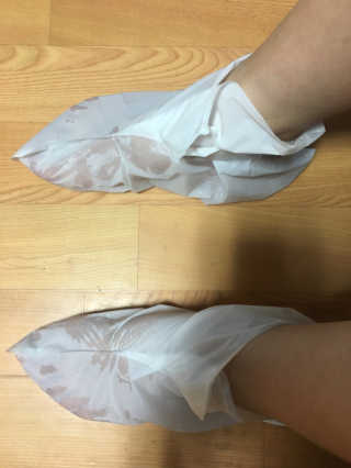 OMYLIFE Skin Freyia Foot Peeling — 2점을 준 리뷰어가 2018년 6월 올린 사용 사진