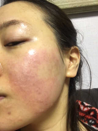 서민정님이 올린 리뷰 사진 1