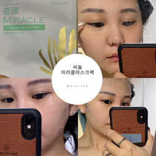보타메디 씨놀®미라클마스크팩 — 5점을 준 리뷰어가 2018년 12월 올린 사용 사진