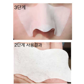 오리지널 미팩토리 3단 돼지코팩 5매입 X 2 — 1.5점을 준 리뷰어가 2018년 7월 올린 사용 사진