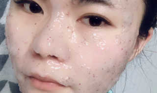 23years old 아쿠아밥 모델링 마스크 — 5점을 준 리뷰어가 2018년 8월 올린 사용 사진