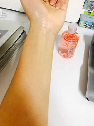 Bio-oil(바이오오일) 바이오오일(Bio-oil) — 3.5점을 준 리뷰어가 2017년 1월 올린 사용 사진