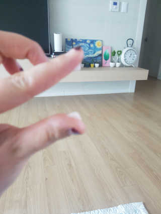 땡큐파머 미라클 에이지 리페어 세럼 — 4점을 준 리뷰어가 2019년 11월 올린 사용 사진