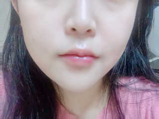 2018 아이소이 잡티세럼 리미티드 컬렉션 — 4.83점을 준 리뷰어가 2018년 7월 올린 사용 사진