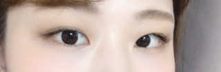Viewty Skin and Lash [ViewtySkin＆Lash] 종아리 림프순환 부종관리 — 3점을 준 리뷰어가 2019년 4월 올린 사용 사진