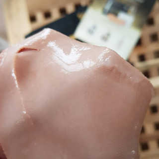 아이디플라코스메틱 아이디 페이스핏 마이너스 밴드 — 3점을 준 리뷰어가 2019년 9월 올린 사용 사진
